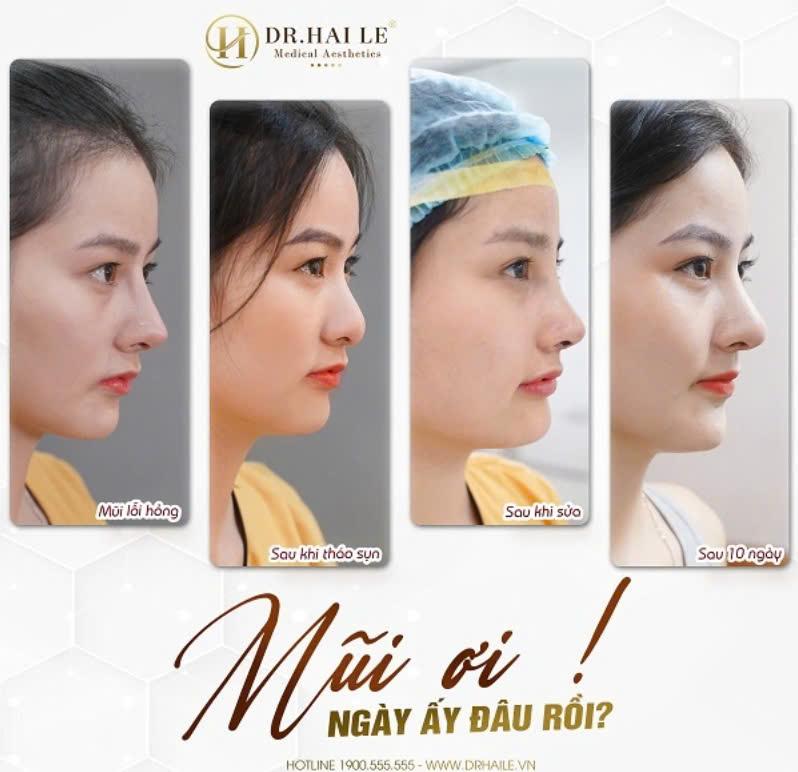 Viện Thẩm Mỹ Y Khoa Dr.Hải Lê