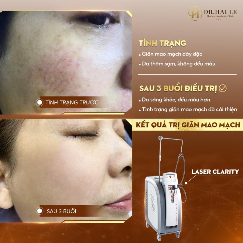 Viện thẩm mỹ y khoa Dr.Hải Lê