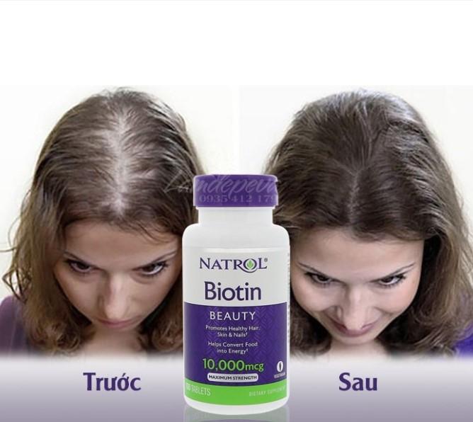 Viên uống mọc tóc Natrol Biotin 10,000 mcg