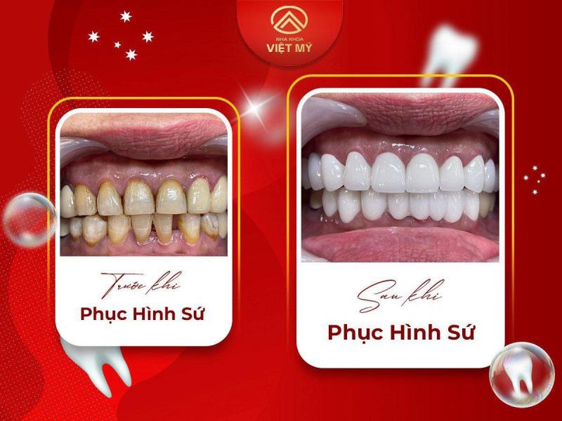 Việt Mỹ - Nha khoa Kỹ thuật cao