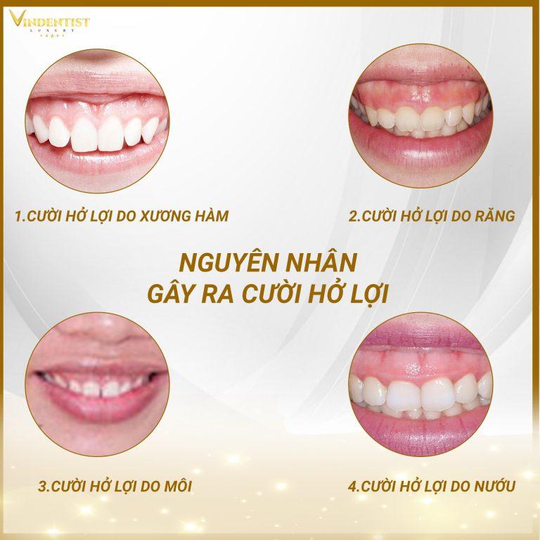 VIN Dentist - Nha Khoa Thẩm Mỹ Số 1 Đà Nẵng