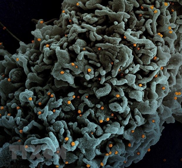 Hình ảnh dưới kính hiển vi một tế bào (màu xanh) của bệnh nhân COVID-19 bị nhiễm biến thể B.1.1.7 của virus SARS-CoV-2 (màu vàng). (Ảnh: AFP/TTXVN)