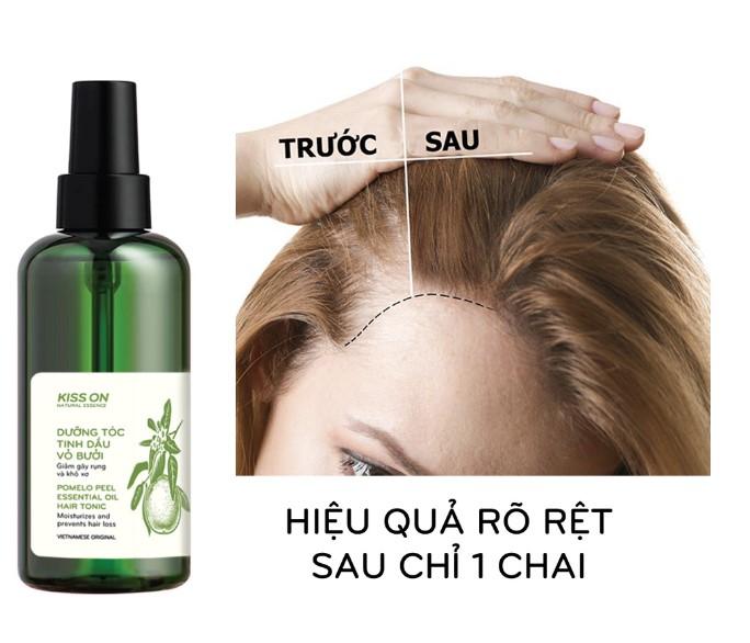 Xịt mọc tóc tinh dầu vỏ bưởi Kiss On