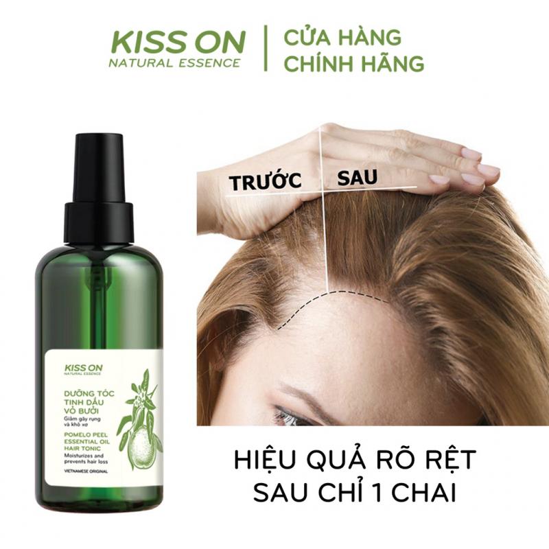 Xịt mọc tóc tinh dầu vỏ bưởi KISS ON