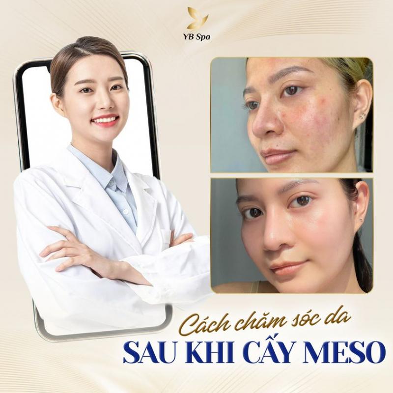 YB Spa Phú Nhuận