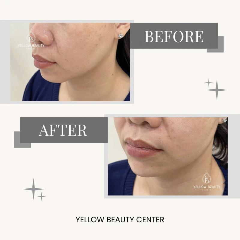 Yellow Beauty Center