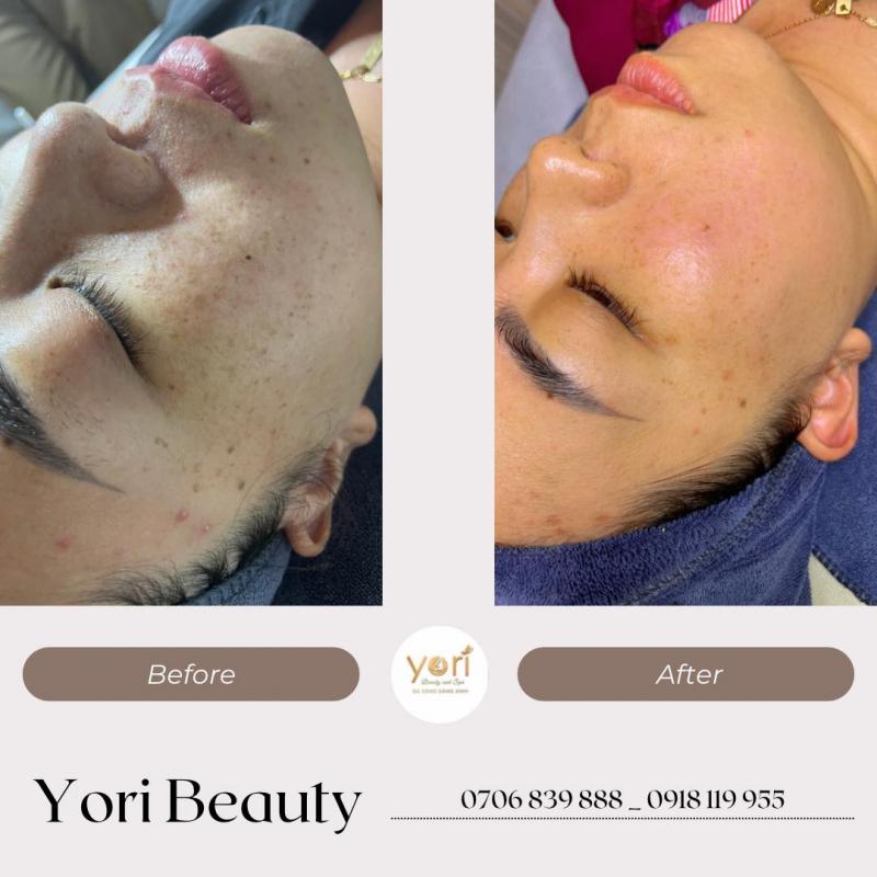 Yori Beauty and Spa